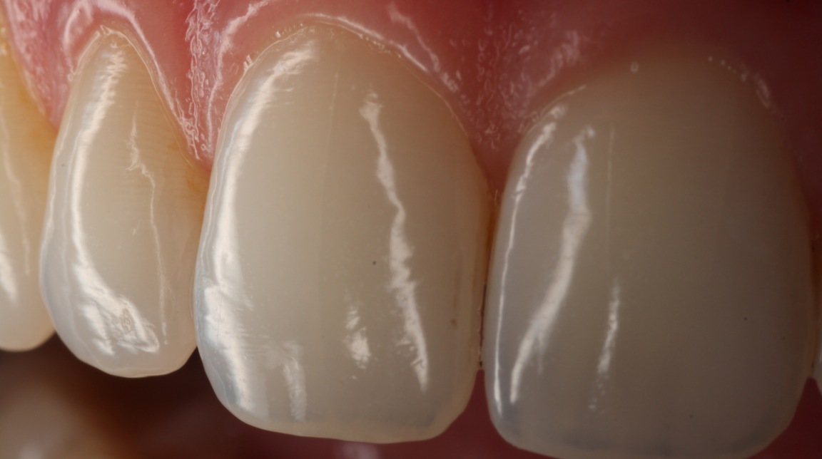 Bekijk Maintain op BITE Functional Dentistry