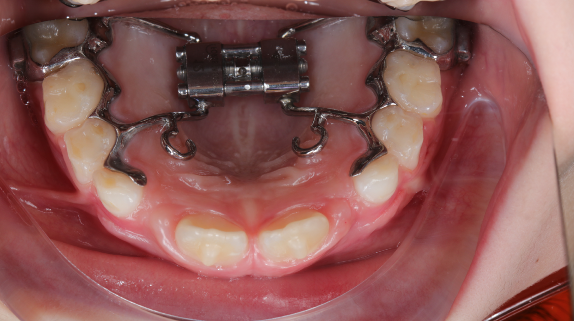 Bekijk Treat op BITE Functional Dentistry
