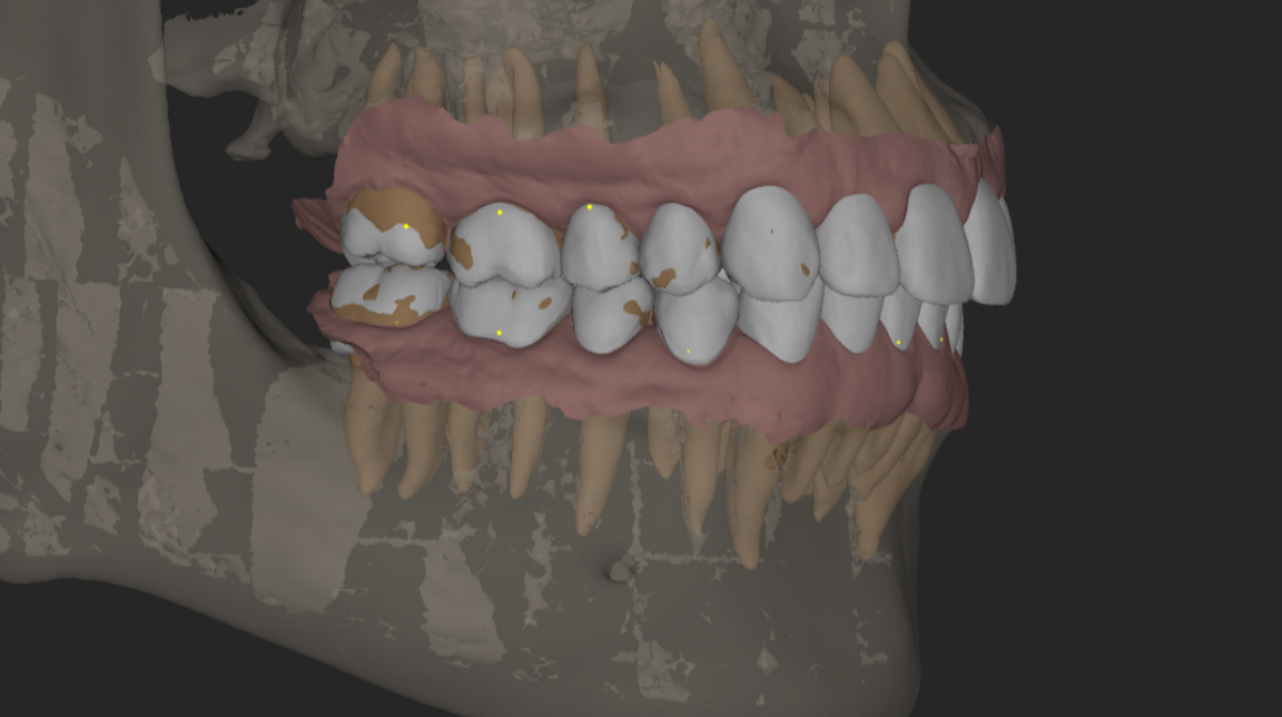 Bekijk Plan op BITE Functional Dentistry