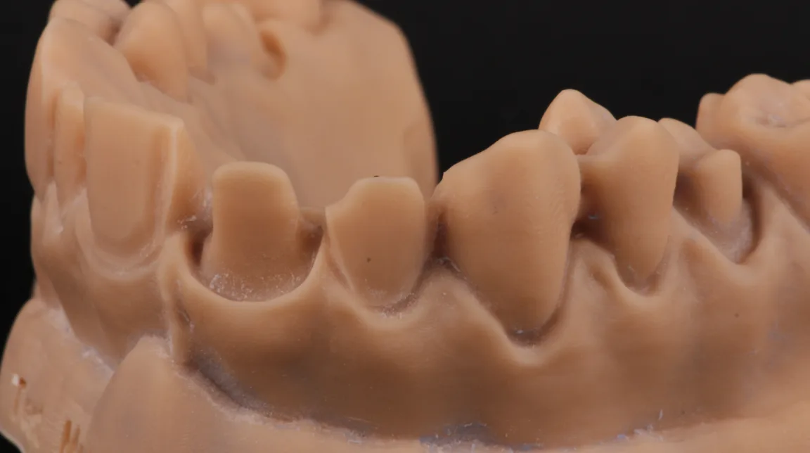 Bekijk Hands on op BITE Functional Dentistry