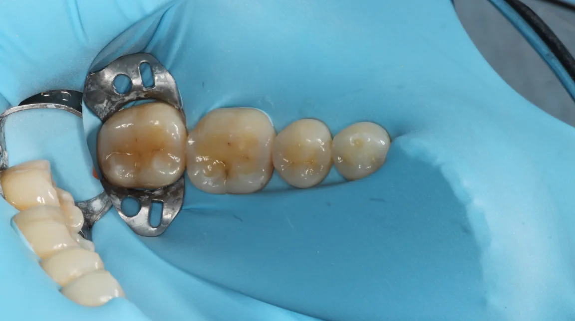 Bekijk Direct aan de slag op BITE Functional Dentistry