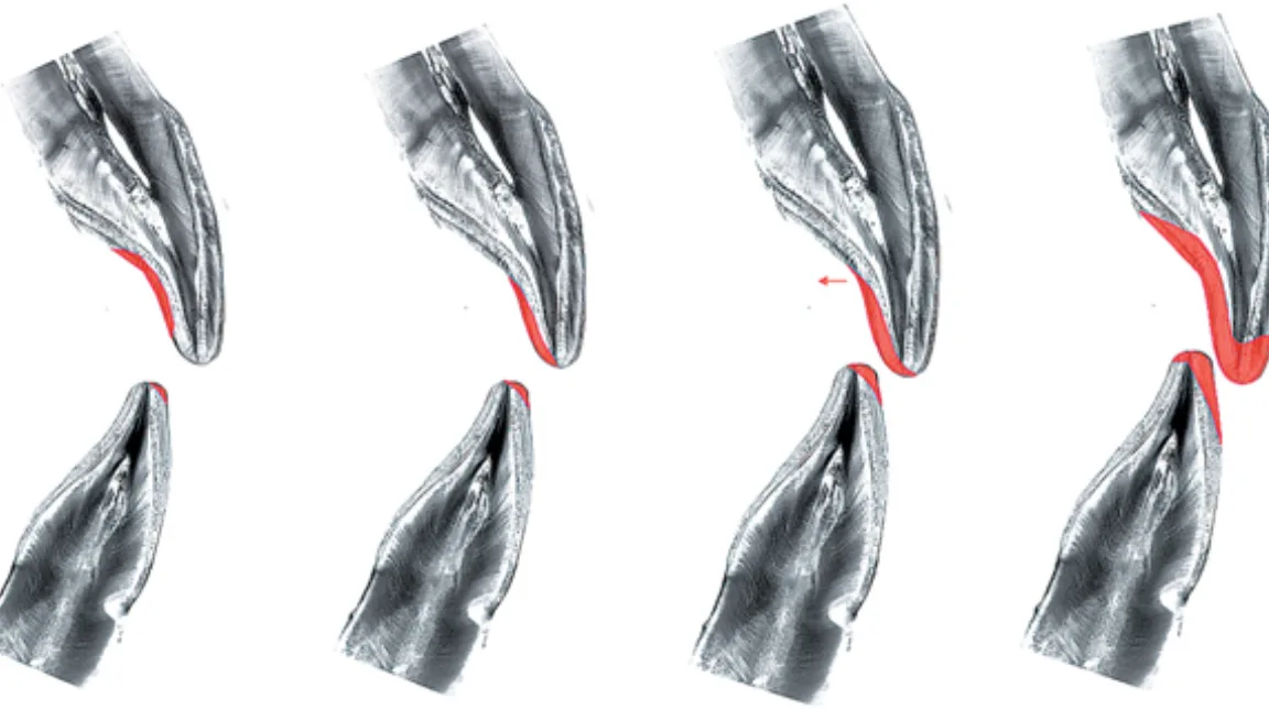 Bekijk Beter interpreteren na correct registreren (deel 2) op BITE Functional Dentistry
