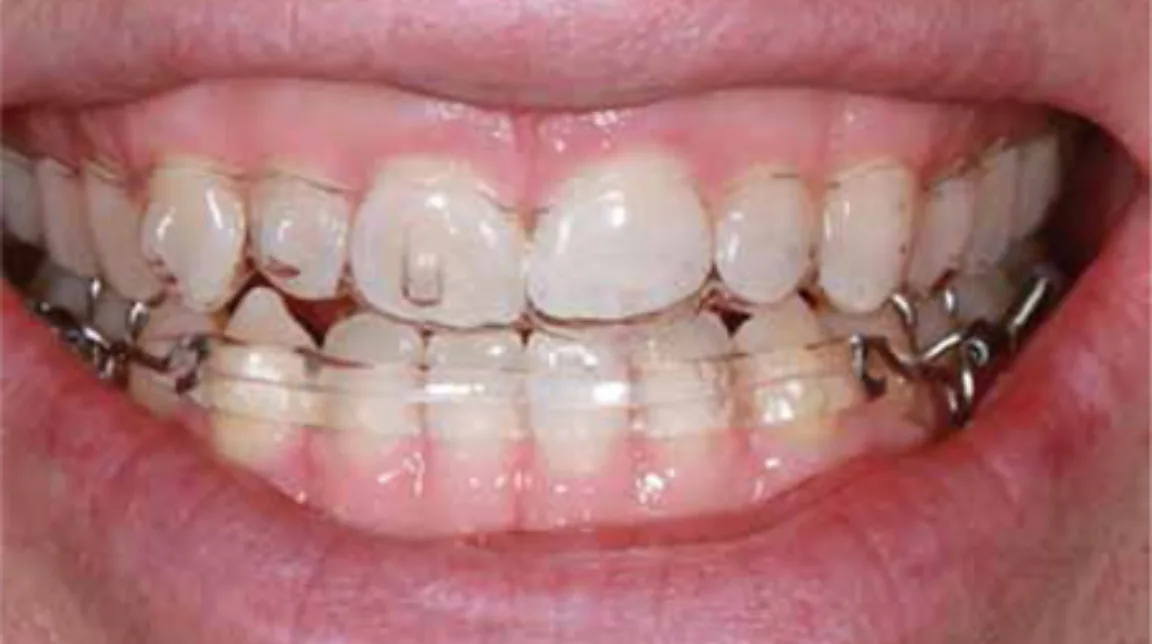 Bekijk Een vragenlijst in de algemene praktijk? De meerwaarde op BITE Functional Dentistry