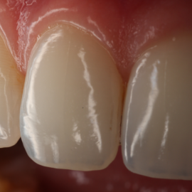 Bekijk deze Maintain op BITE Functional Dentistry 