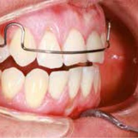 Bekijk deze Meer dan alleen een leuke theorie; CR of MO (deel 1) op BITE Functional Dentistry 