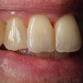 Bekijk deze Op elkaars lip op BITE Functional Dentistry 