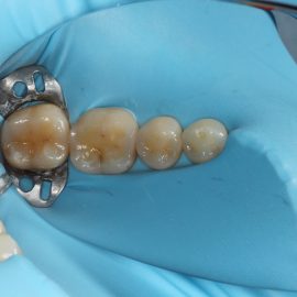 Bekijk deze Direct aan de slag op BITE Functional Dentistry 