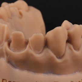 Bekijk deze Hands on op BITE Functional Dentistry 