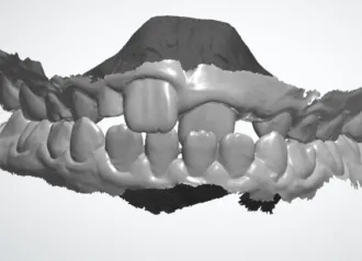 Bekijk deze BITE Continuum 2027 op BITE Functional Dentistry 