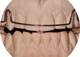 Bekijk deze Oude module I: Functional occlusion op BITE Functional Dentistry 