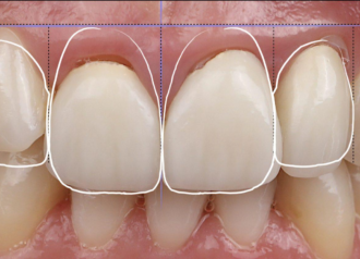 Bekijk deze Laatste module III 2026: Advanced treatment planning op BITE Functional Dentistry 
