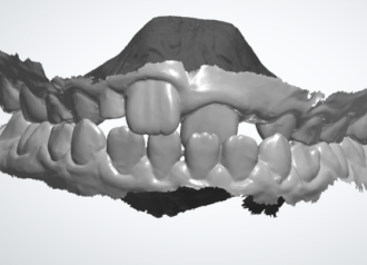 Bekijk deze BITE Continuum 2027 op BITE Functional Dentistry 