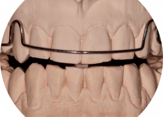 Bekijk deze Module I: Functional occlusion op BITE Functional Dentistry 