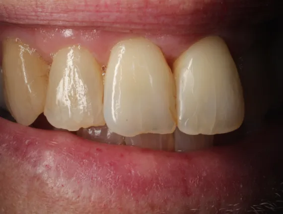 Bekijk deze Op elkaars lip op BITE Functional Dentistry 