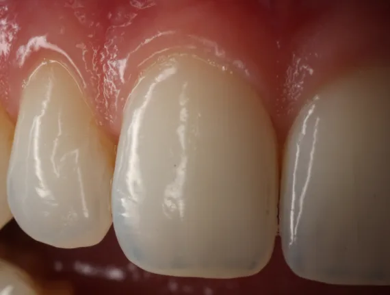 Bekijk deze Esthetische kaders op BITE Functional Dentistry 