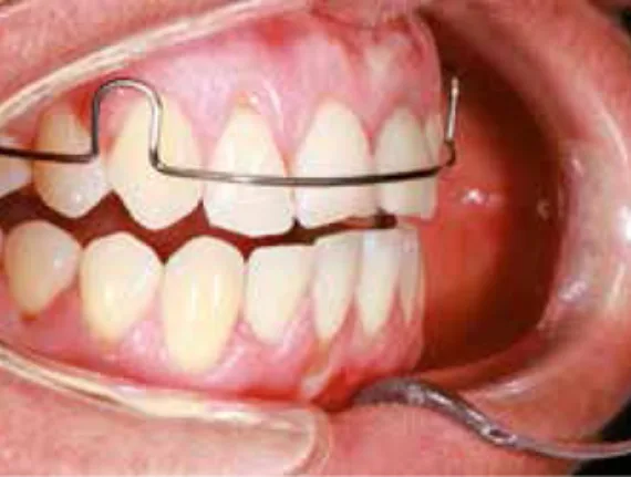 Bekijk deze Meer dan alleen een leuke theorie; CR of MO (deel 1) op BITE Functional Dentistry 