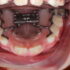 Bekijk deze Treat op BITE Functional Dentistry 