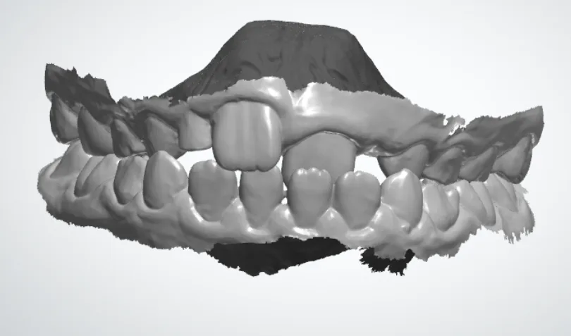 View this image on BITE Functional Dentistry 