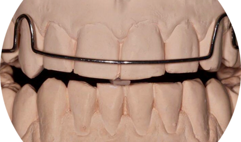 Bekijk deze afbeelding op BITE Functional Dentistry 