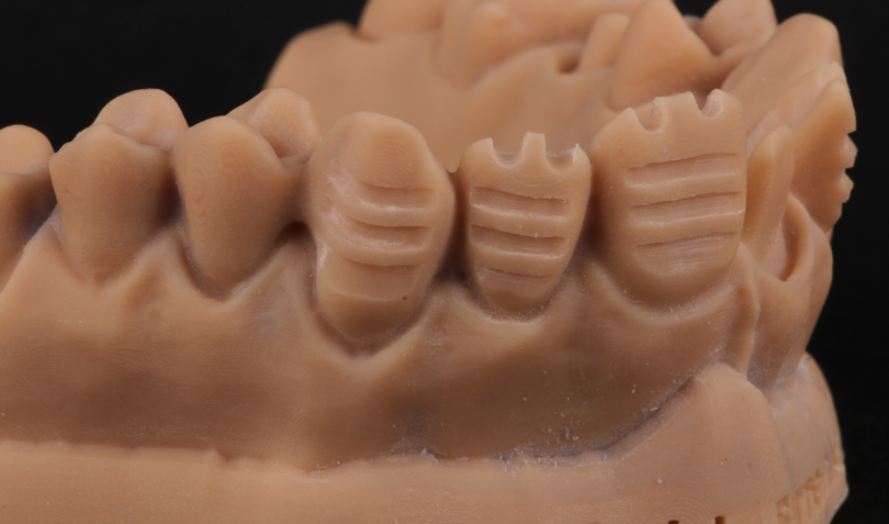 Bekijk deze afbeelding op BITE Functional Dentistry 