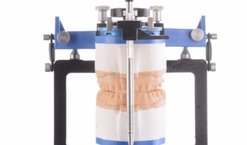 Bekijk deze afbeelding op BITE Functional Dentistry 