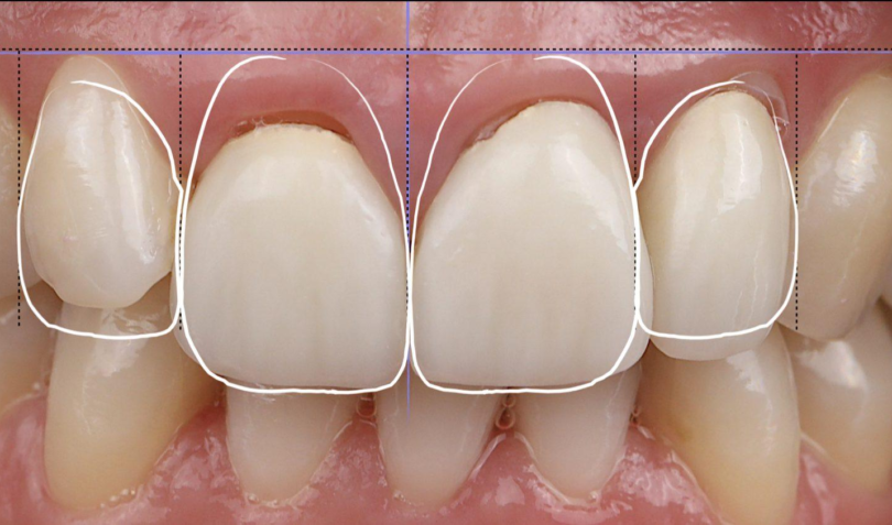 Bekijk deze afbeelding op BITE Functional Dentistry 