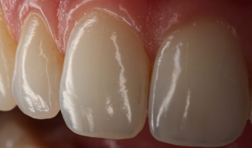 View this image on BITE Functional Dentistry 