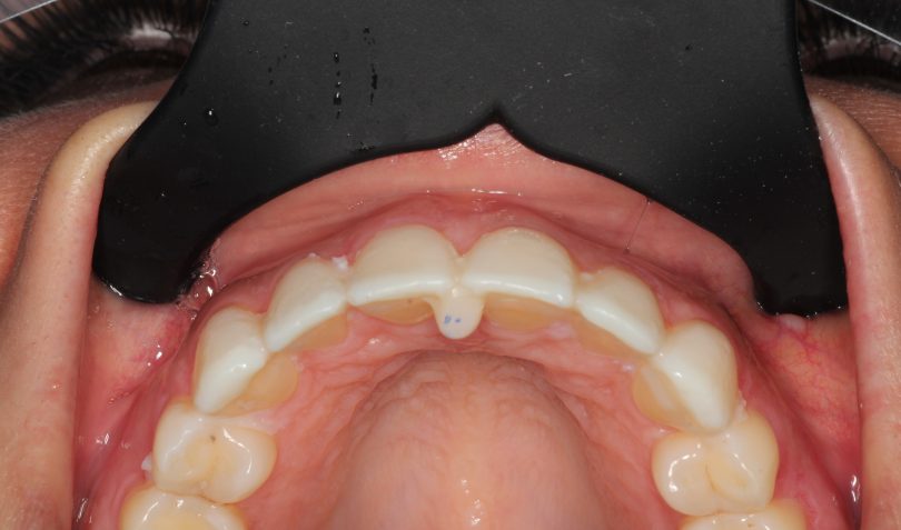 Bekijk deze afbeelding op BITE Functional Dentistry 