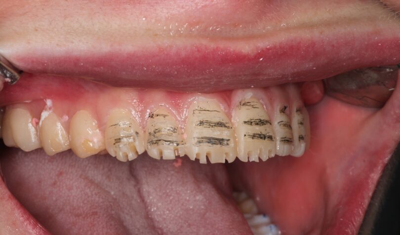 Bekijk deze afbeelding op BITE Functional Dentistry 