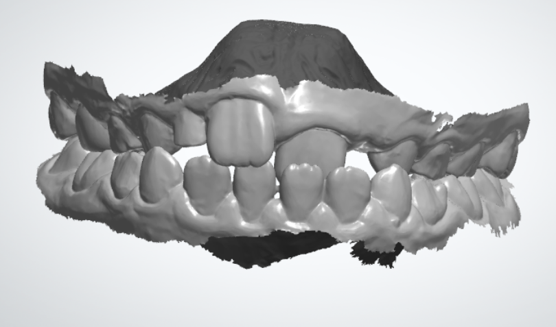 View this image on BITE Functional Dentistry 