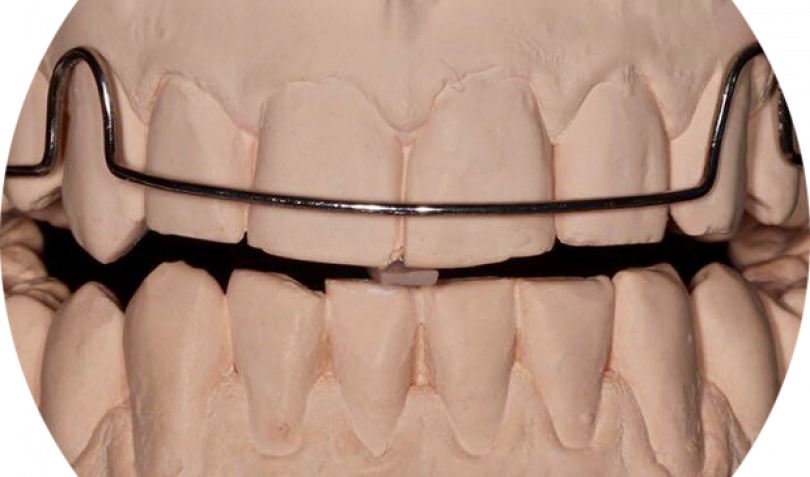 Bekijk deze afbeelding op BITE Functional Dentistry 