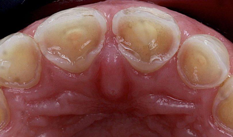 View this image on BITE Functional Dentistry 